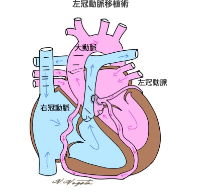 下大静脈弁